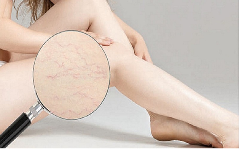 Hướng dẫn cách chăm sóc da body mỏng, giúp da khỏe đẹp tự nhiên